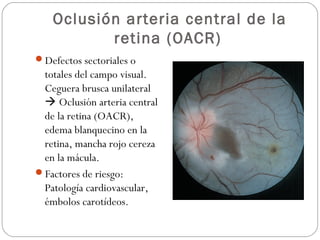 Oclusión arteria central de la
retina (OACR)
Defectos sectoriales o
totales del campo visual.
Ceguera brusca unilateral
 Oclusión arteria central
de la retina (OACR),
edema blanquecino en la
retina, mancha rojo cereza
en la mácula.
Factores de riesgo:
Patología cardiovascular,
émbolos carotídeos.
 