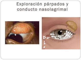 Exploración párpados y
conducto nasolagrimal
 