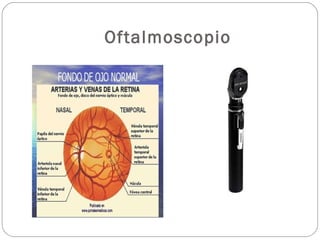 Oftalmoscopio
 