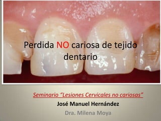 Perdida NO cariosa de tejido
dentario
Seminario “Lesiones Cervicales no cariosas”
José Manuel Hernández
Dra. Milena Moya
 