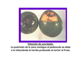 Infección de una lesión.
La pudrición de la zona contigua al pedúnculo se debe
a la infecciónde la herida producida al cortar el fruto.
 