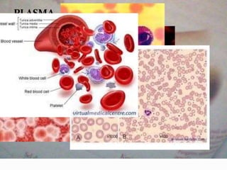 SERUM 
SEL 
DARAH 
PUTIH 
SEL 
DARAH 
MERAH 
TROMBOS 
IT 
PLASMA 
DARAH 
 