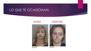 LO QUE TE OCASIONAN:
ANTES DESPUES
 