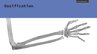 @thisNatasha
Ossification
 