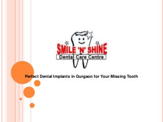 Perfect Dental Implants in Gurgaon for Your Missing Tooth

 