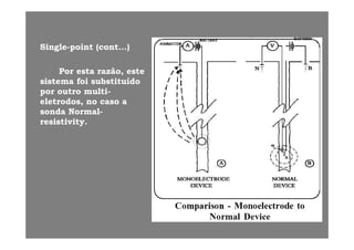 SingleSingle--pointpoint (cont...)(cont...)
ããPorPor estaesta razãorazão,, esteeste
sistemasistema foifoi substituídosubstituído
porpor outrooutro multimulti--
eletrodoseletrodos, no, no casocaso aa
sondasonda NormalNormal--
resistivity.resistivity.yy
 