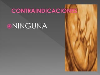 NINGUNA
 