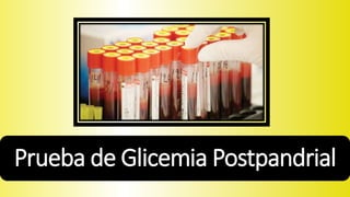 Prueba de Glicemia Postpandrial 
 
