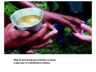 Mão de José ferida pelo trabalho no pasto
e água que os trabalhadores bebiam
 