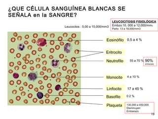 ¿QUE CÉLULA SANGUÍNEA BLANCAS SE
SEÑALA en la SANGRE?
Eritrocito
Neutrofilo
Monocito
Linfocito
Basofilo
Plaqueta
Eosinófilo
19
17 a 45 %
0,5 a 4 %
55 a 70 %
4 a 10 %
0.2 %
Leucocitos : 5,00 a 15,000/mm3
LEUCOCITOSIS FISIOLÓGICA
Embzo:10, 000 a 12,000/mm3
Parto: 13 a 18,000/mm3
90%
embarazo
130,000 a 450,000
Disminuyen
Embarazo
 