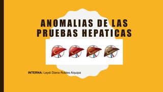 ANOMALIAS DE L AS
PRUEBAS HEPATICAS
INTERNA: Leydi Diana Robles Aiquipa
 