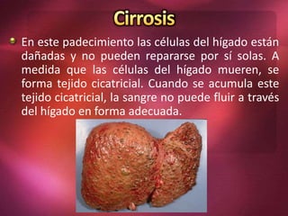En este padecimiento las células del hígado están
dañadas y no pueden repararse por sí solas. A
medida que las células del hígado mueren, se
forma tejido cicatricial. Cuando se acumula este
tejido cicatricial, la sangre no puede fluir a través
del hígado en forma adecuada.
 