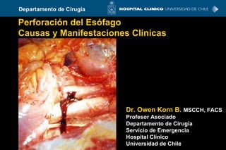 Perforación del Esófago Causas y Manifestaciones Clínicas Dr. Owen Korn B.   MSCCH, FACS Profesor Asociado Departamento de Cirugía Servicio de Emergencia Hospital Clínico Universidad de Chile 
