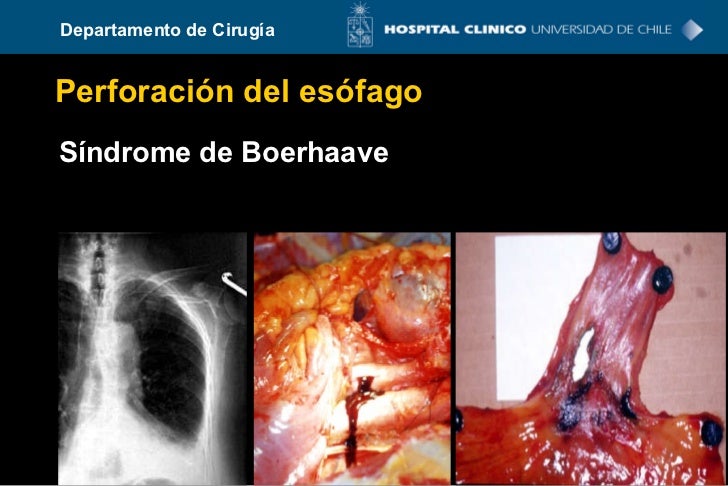 perforación sofá perforación sofá