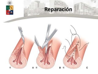 Reparación
 