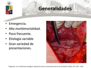 Generalidades
• Emergencia.
• Alta morbimortalidad.
• Poco frecuente.
• Etiología variable
• Gran variedad de
presentaciones.
Braguetto I, et al. Perforación esofágica. Experiencia clínica y actualización del tema. Rev Med Chi 2005; 133: 1233 – 1241.
 
