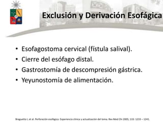 Exclusión y Derivación Esofágica
• Esofagostoma cervical (fístula salival).
• Cierre del esófago distal.
• Gastrostomía de descompresión gástrica.
• Yeyunostomía de alimentación.
Braguetto I, et al. Perforación esofágica. Experiencia clínica y actualización del tema. Rev Med Chi 2005; 133: 1233 – 1241.
 