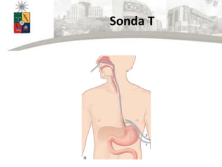Sonda T
 