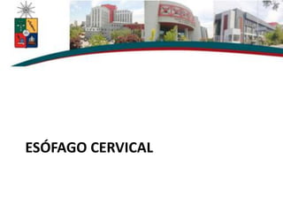 ESÓFAGO CERVICAL
 
