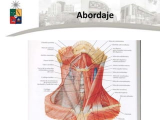 Abordaje
 