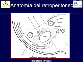 Anatomía del retroperitoneo




       Yagan N et al. Radiology 2009;250:740-748

           Radiología e Imagen
 