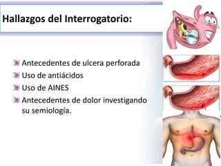 Hallazgos del Interrogatorio:
Antecedentes de ulcera perforada
Uso de antiácidos
Uso de AINES
Antecedentes de dolor investigando
su semiología.
 