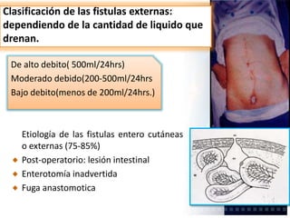 Clasificación de las fistulas externas:
dependiendo de la cantidad de liquido que
drenan.
De alto debito( 500ml/24hrs)
Moderado debido(200-500ml/24hrs
Bajo debito(menos de 200ml/24hrs.)
Etiología de las fistulas entero cutáneas
o externas (75-85%)
Post-operatorio: lesión intestinal
Enterotomía inadvertida
Fuga anastomotica
 
