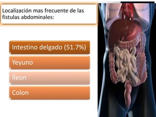 Intestino delgado (51.7%)
Yeyuno
Íleon
Colon
Localización mas frecuente de las
fistulas abdominales:
 