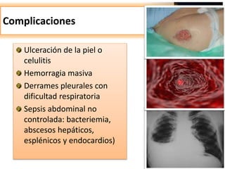 Complicaciones
Ulceración de la piel o
celulitis
Hemorragia masiva
Derrames pleurales con
dificultad respiratoria
Sepsis abdominal no
controlada: bacteriemia,
abscesos hepáticos,
esplénicos y endocardios)
 