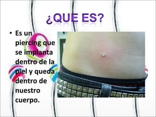 Es un piercing que se implanta dentro de la piel y queda dentro de nuestro cuerpo.  