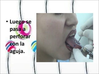 Luego se pasa a perforar con la aguja. 