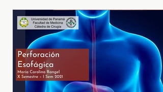 Perforación
Esofágica
María Carolina Rangel
X Semestre – I Sem 2021
Universidad de Panamá
Facultad de Medicina
Cátedra de Cirugía
 