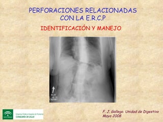 PERFORACIONES RELACIONADAS CON LA E.R.C.P F. J. Gallego. Unidad de Digestivo Mayo 2008 IDENTIFICACIÓN Y MANEJO 
