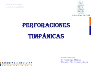 Facultad de Cs. De la Salud Escuela de Tecnología Médica Perforaciones TIMPÁNICAS Erika Molina O.III Tecnología MédicaMención Otorrinolaringología 