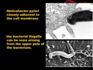 Helicobacter pylori
closely adherent to
the cell membrane
the bacterial flagella
can be seen arising
from the upper pole of
the bacterium.
 