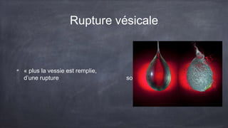 Rupture vésicale 
« plus la vessie est remplie, plus les risques 
d’une rupture sont importants » 
 