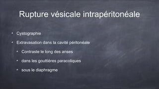 Rupture vésicale intrapéritonéale 
Cystographie 
Extravasation dans la cavité péritonéale 
Contraste le long des anses 
dans les gouttières paracoliques 
sous le diaphragme 
 