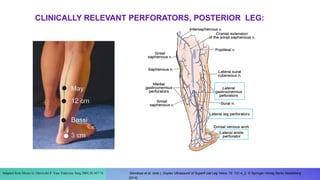 Adapted from Mozes G, Gloviczki P: Vasc Endovasc Surg 2004;38:367-74.
great
Mendoza et al. (eds.), Duplex Ultrasound of Superfi cial Leg Veins, 19 731-4_2, © Springer-Verlag Berlin Heidelberg
2014]
CLINICALLY RELEVANT PERFORATORS, POSTERIOR LEG:
 
