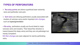  Re-entry points are where superficial lower extremity
veins and perforator veins join.
 Exit veins are refluxing perforators usually associated with
clusters of varicose veins and/or important skin changes,
such as hyperpigmentation
Re-entry perforators usually are found distal to major
varicose veins and clusters. Their blood flow direction is
inward (toward the deep veins) and they are not pathologic but
merely competent.
NO Skin changes are seen adjacent to reentry perforating
veins
Pascarella, L., Mekenas, L., (2007). Ultrasound examination of the patient with primary venous Insufficiency, The Vein Book.
TYPES OF PERFORATORS
 