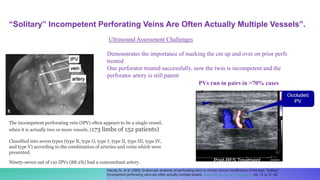PVs run in pairs in >70% cases
Ultrasound Assessment Challenges
Demonstrates the importance of marking the cm up and over on prior perfs
treated
One perforator treated successfully, now the twin is incompetent and the
perforator artery is still patent
The incompetent perforating vein (IPV) often appears to be a single vessel,
when it is actually two or more vessels. (173 limbs of 152 patients)
Classified into seven types (type N, type O, type I, type II, type III, type IV,
and type V) according to the combination of arteries and veins which were
presented.
Ninety-seven out of 110 IPVs (88.2%) had a concomitant artery.
Haruta, N., et al. (2004). Endoscopic anatomy of perforating veins in chronic venous insufficiency of the legs: “Solitary”
incompetent perforating veins are often actually multiple vessels. International Journal of Angiology vol. 13, p. 31–36.
“Solitary” Incompetent Perforating Veins Are Often Actually Multiple Vessels”.
 