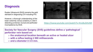 Duplex Ultrasound (DUS) remains the gold
standard in diagnosing CVI including PVI.
However, a thorough understanding of the
lower extremity venous anatomy is vital in
detecting junctional, truncal and perforator
incompetence by DUS.
Society for Vascular Surgery (SVS) guidelines deﬁne a ‘pathological’
perforator vein based on:
 the anatomical location beneath an active or healed ulcer
 with a reﬂux lasting ≥ 500 milliseconds
 and a diameter ≥ 3.5 mm.
https://www.youtube.com/watch?v=4noBuGHsiMI
Diagnosis
 