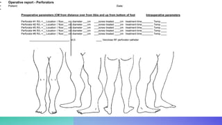 • Operative report - Perforators
• Patient: Date:
•
Preoperative parameters (CM from distance over from tibia and up from bottom of foot Intraoperative parameters
Perforator #1 R/L->__Location ↑ floor___ cm diameter ___cm ___zones treated ____cm treatment time________ Temp.____
Perforator #2 R/L->__Location ↑ floor___ cm diameter ___cm ___zones treated ____cm treatment time________ Temp.____
Perforator #3 R/L->__Location ↑ floor___ cm diameter ___cm ___zones treated ____cm treatment time________ Temp.____
Perforator #4 R/L->__Location ↑ floor___ cm diameter ___cm ___zones treated ____cm treatment time________ Temp.____
Perforator #5 R/L->__Location ↑ floor___ cm diameter ___cm ___zones treated ____cm treatment time________ Temp.____
____________________________, M.D. ____ Venclose RF perforator catheter
 