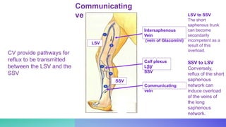 Intersaphenous
Vein
(vein of Giacomini)
Communicating
veins
Calf plexus
LSV
SSV
Communicating
vein
SSV
LSV
CV provide pathways for
reflux to be transmitted
between the LSV and the
SSV
SSV to LSV
Conversely,
reflux of the short
saphenous
network can
induce overload
of the veins of
the long
saphenous
network.
LSV to SSV
The short
saphenous trunk
can become
secondarily
incompetent as a
result of this
overload.
 