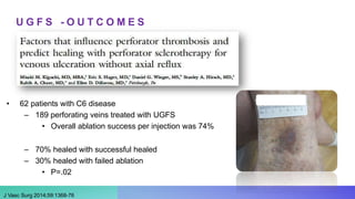 U G F S - O U T C O M E S
• 62 patients with C6 disease
– 189 perforating veins treated with UGFS
• Overall ablation success per injection was 74%
– 70% healed with successful healed
– 30% healed with failed ablation
• P=.02
J Vasc Surg 2014;59:1368-76
 
