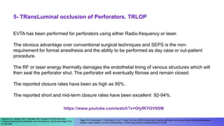 EVTA has been performed for perforators using either Radio-frequency or laser.
The obvious advantage over conventional surgical techniques and SEPS is the non-
requirement for formal anesthesia and the ability to be performed as day case or out-patient
procedure.
The RF or laser energy thermally damages the endothelial lining of venous structures which will
then seal the perforator shut. The perforator will eventually fibrose and remain closed.
The reported closure rates have been as high as 95% .
The reported short and mid-term closure rates have been excellent 92-94%.
5- TRansLuminal occlusion of Perforators. TRLOP
Kuyumcu G, Salazar GM, Prabhakar AM, Ganguli S (2016) Minimally
invasive treatments for perforator vein insuﬃciency. Cardiovasc Diagn Ther
6: 593-598.
Hager ES, Washington C, Steinmetz A, Wu T, Singh M, et al. (2016) Factors that inﬂuence perforator vein closure rates using radiofrequency
ablation, laser ablation, or foam sclerotherapy. J Vasc Surg Venous Lymphat Disord 4: 51-56.
https://www.youtube.com/watch?v=OlyfKYGV9SM
 
