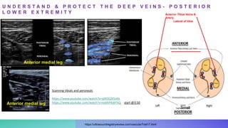 Anterior medial leg
Anterior medial leg
Anterior Tibial Veins &
Artery
Lateral of tibia
Small
Scanning tibials and peroneals
https://www.youtube.com/watch?v=q9lOQ3tSnKk
https://www.youtube.com/watch?v=oo0hPKdtFSQ start @3:50
U N D E R S T A N D & P R O T E C T T H E D E E P V E I N S - P O S T E R I O R
L O W E R E X T R E M I T Y
https://ultrasoundregistryreview.com/vascularTrial17.html
 