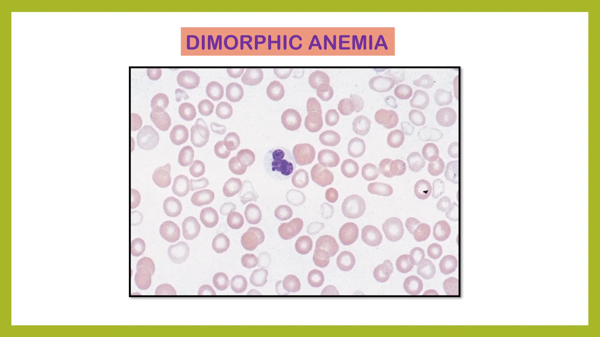 PERFORM, IDENTIFY AND DESCRIBE THE PERIPHERAL BLOOD.pptx