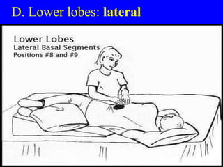 Llsb Performing chest physiotherapy | PPT