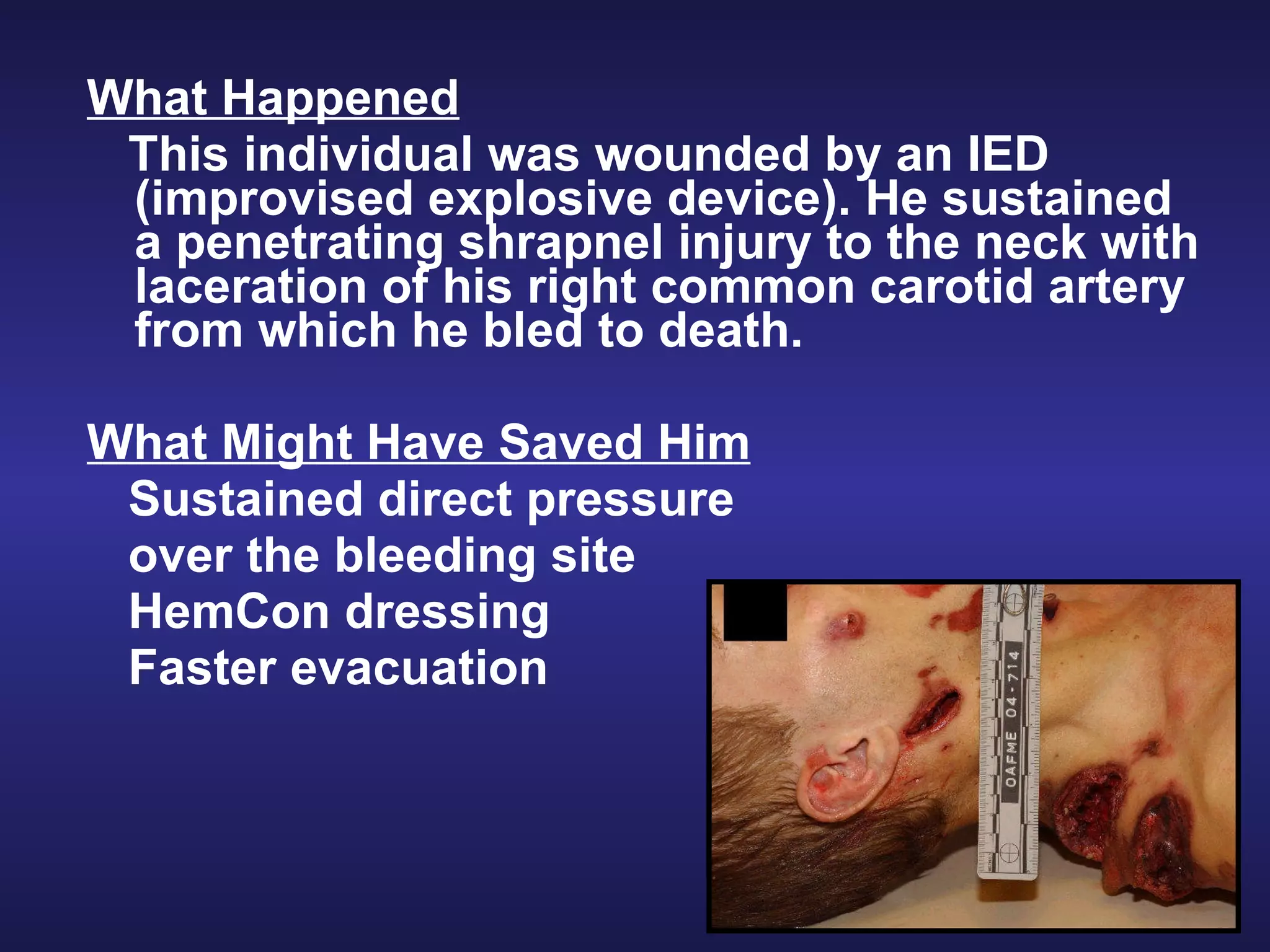 Perform tactical combat casualty care | PPT | First Aid | Injuries