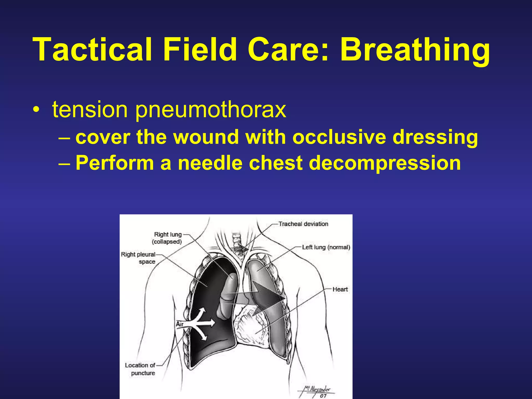 Perform tactical combat casualty care | PPT | First Aid | Injuries